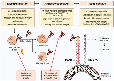 Strategies Towards Antigen-Specific Treatments for Membranous Nephropathy